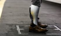 BionicM a jejich inovativní protéza